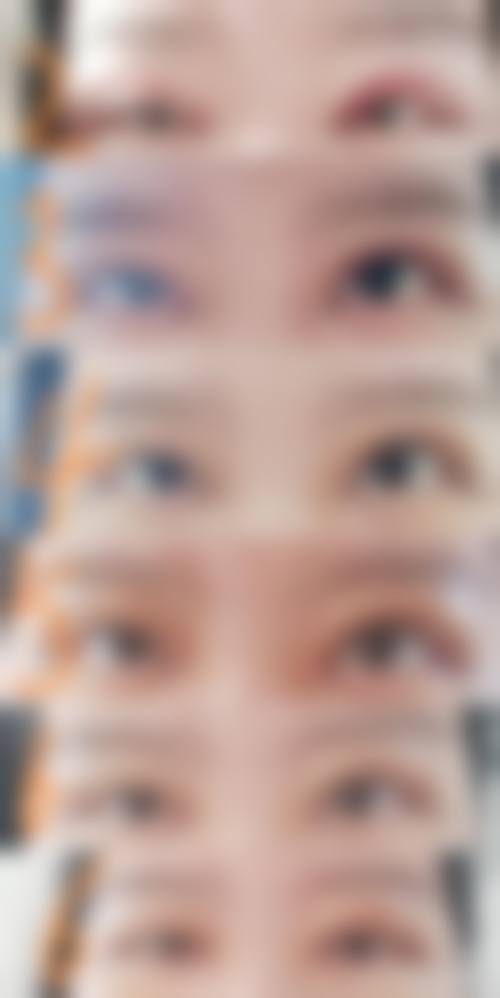 五、长春圣颜医疗美容诊所实例