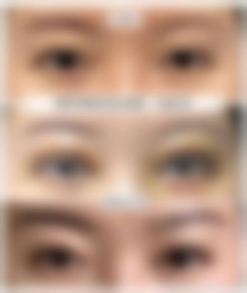 五、济南鹏爱美康医疗美容诊所实例