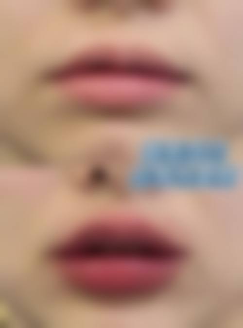 六、杭州市红十字会医院整形外科价格表：（仅供参考）