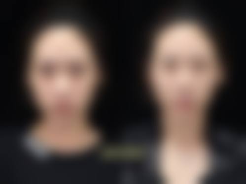 吴新民医生在哪家医院怎么预约？