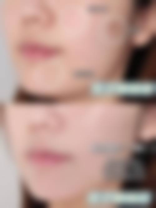 七、长春圣颜医疗美容诊所价格表：（仅供参考）