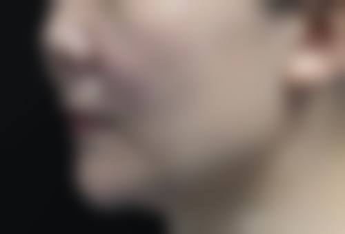 八、河南省煤炭总医院整形科真实的顾客评价如下：