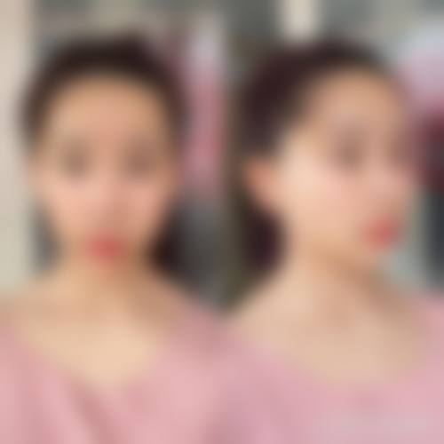 八、洪山颜范天美医疗美容门诊部真实的顾客评价如下：