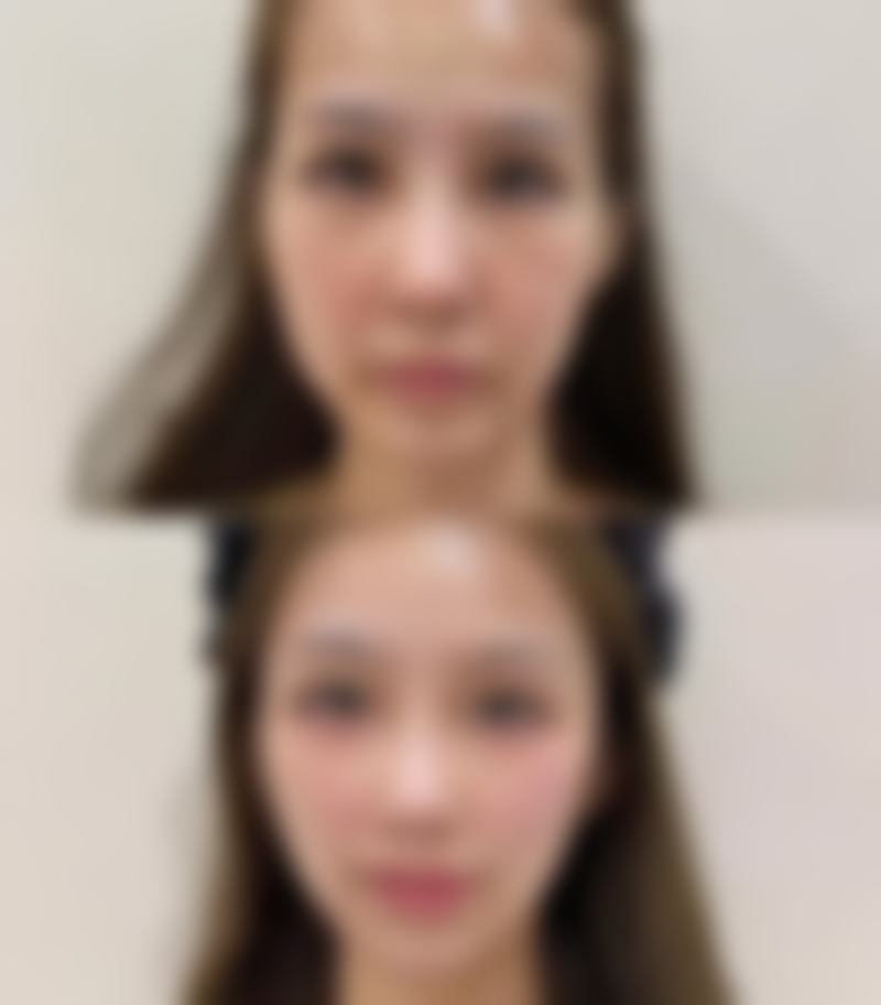 八、济南鹏爱美康医疗美容诊所真实的顾客评价如下：