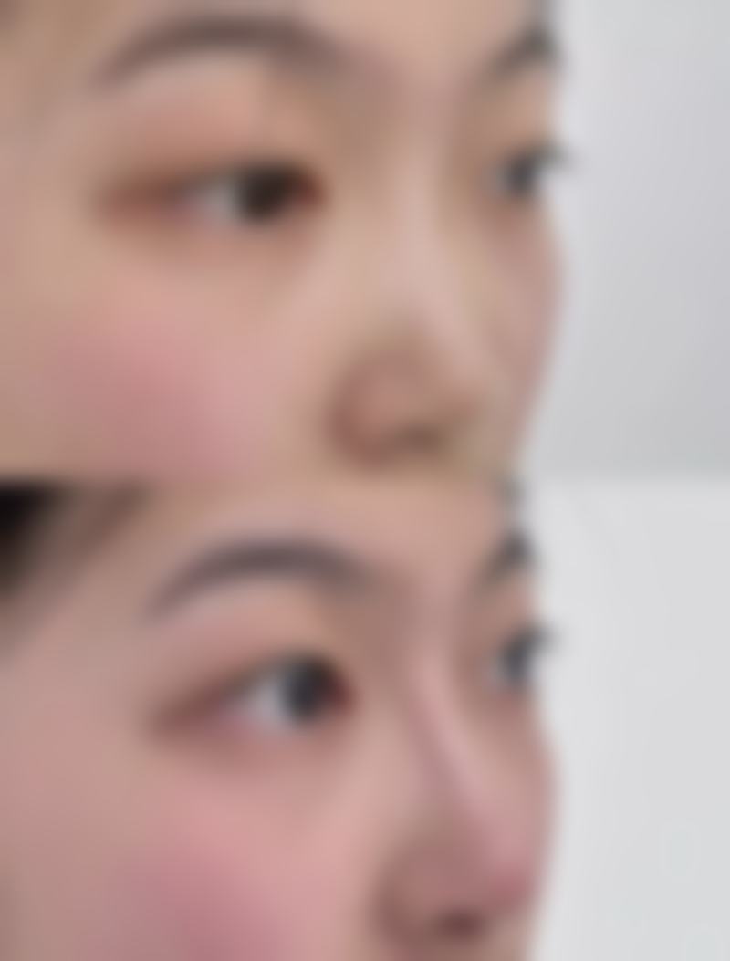 七、河南省煤炭总医院整形科价格表：（仅供参考）