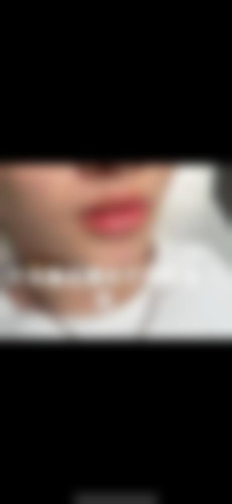 五、郴州市明华医院医学美容科实例