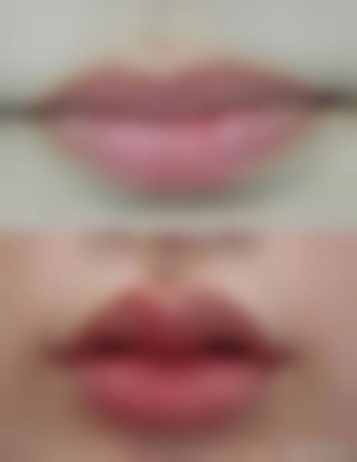 八、郴州市明华医院医学美容科真实的顾客评价如下：