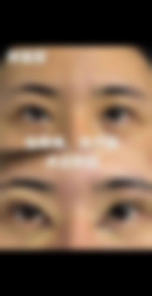 七、韩国美特乐整形外科医院价格表：（仅供参考）