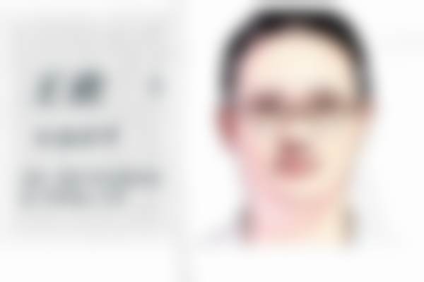 成都武侯华生铂悦美容医院国产瘦肩项目真实评价