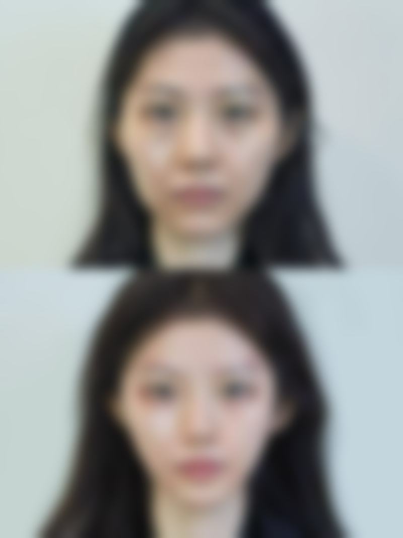 七、开封示范区启美医疗美容诊所价格表：（仅供参考）