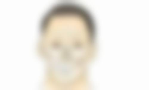 抽脂术后首月：成效补充说明