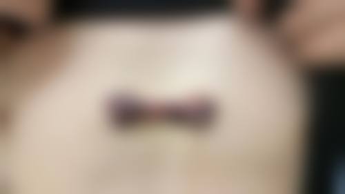 八、广州疤博士医学整形美容医院真实的顾客评价如下：
