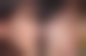 五、南昌艾莱芙医疗美容医院（原爱思特）实例