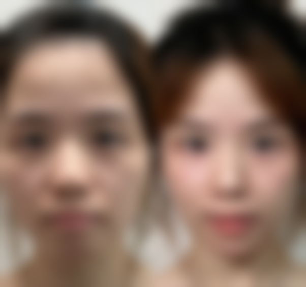八、成都青妍医疗美容诊所真实的顾客评价如下：