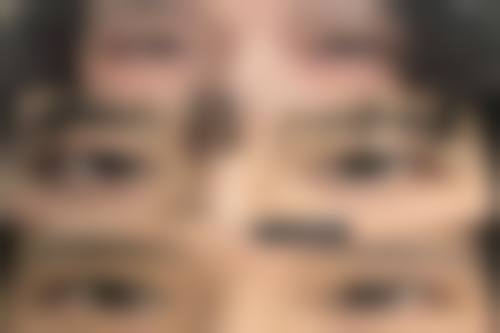 四、长沙谢磊天一医疗美容诊所实例