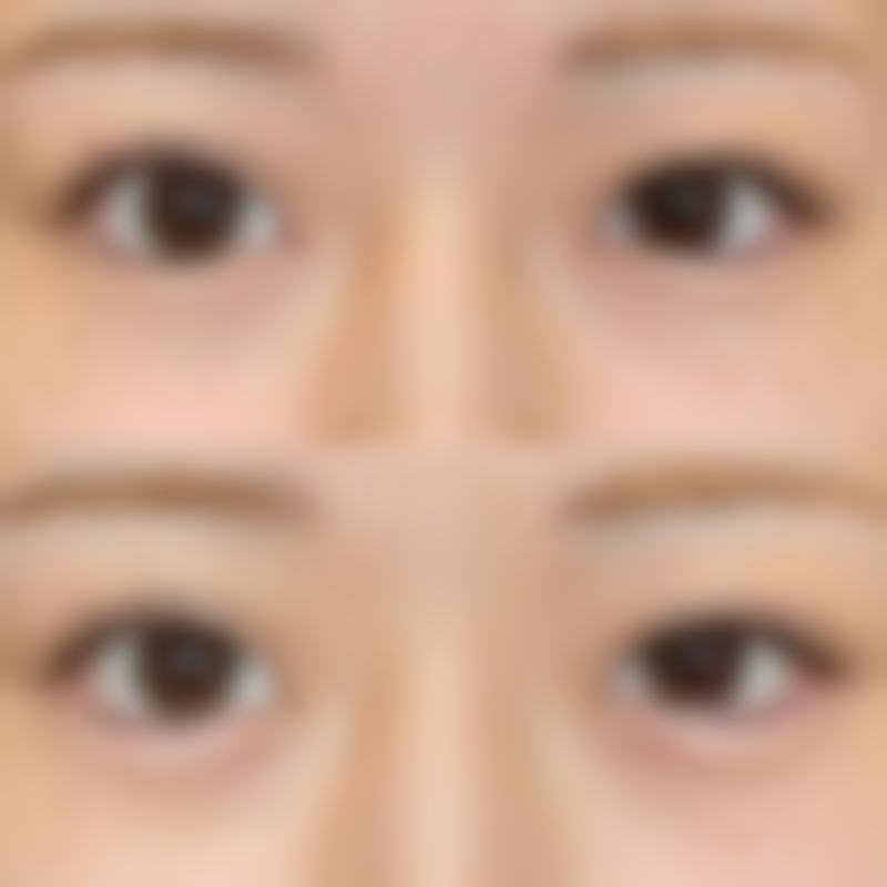 四、滁州水光工坊整形医院开展的主要项目和特色项目：