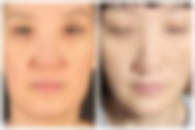 怎样效率高消除眼袋？眼霜选择要恰当