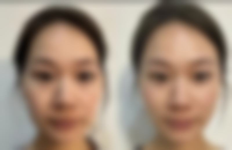 赵屹东医生实例