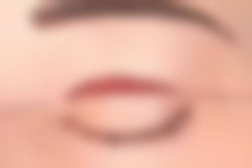 日常护理与修复辅助