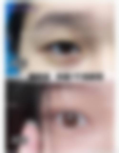 三、广州医和你整形医院医生介绍: