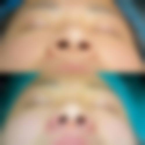 五、西安瑞丽医疗美容专科医院实例