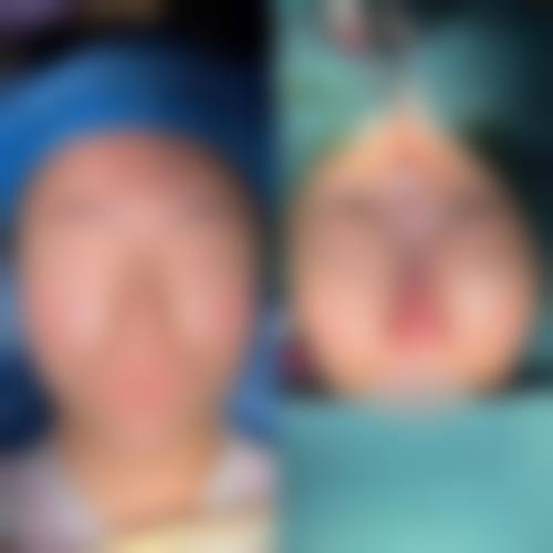 六、驻马店电力医院皮肤激光整形医学美容中 心价格表：（仅供参考）