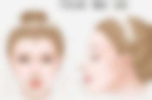双眼皮割窄了能加宽吗？修复时机要把握
