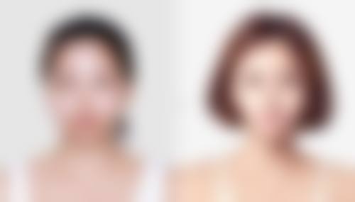 瘦脸针效果究竟能保持多久？揭秘影响时长因素及延长效果的实用秘籍