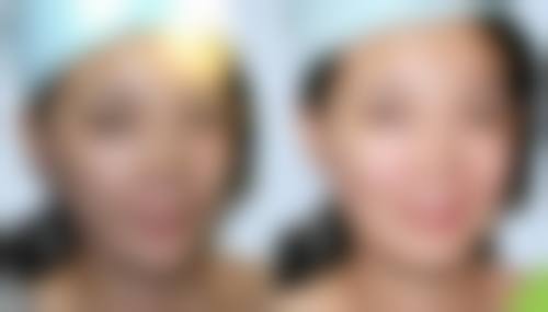 六、肇庆华美医疗整形怎么预约：