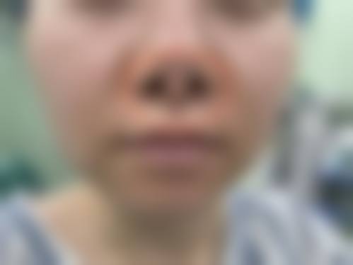 七、江油悦享舒雨整形医院真实的顾客评价如下：