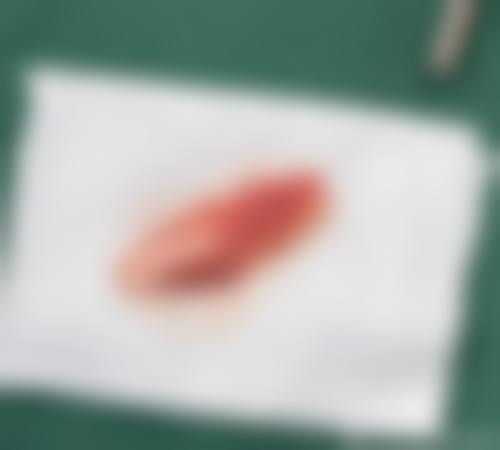 八、镇江市伊美尔整形美容医院真实的顾客评价如下：