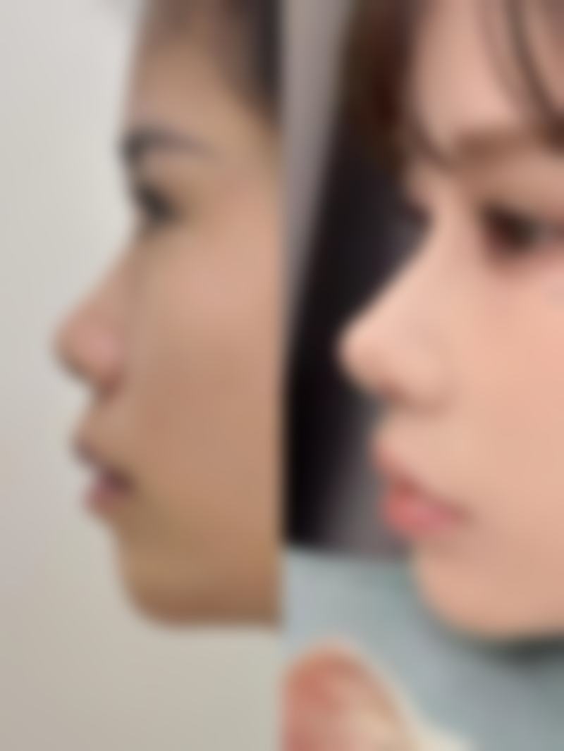 五、赣州叶子整形医院实例
