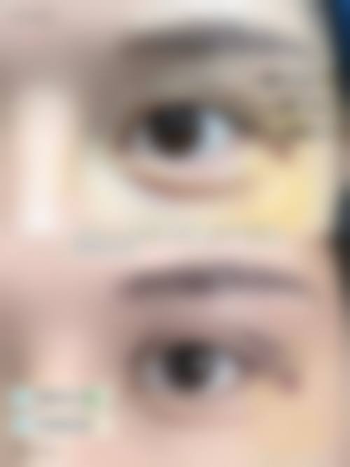 八、江苏连云港大明医学美容中 心真实的顾客评价如下：