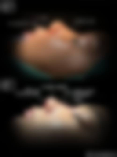 六、昆明华美美莱整形美容医院怎么预约：