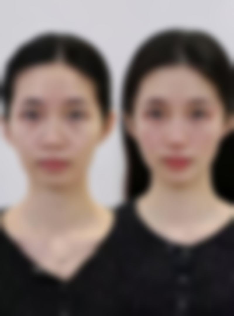 八、衢州柯城丽芯颜整形医院真实的顾客评价如下：
