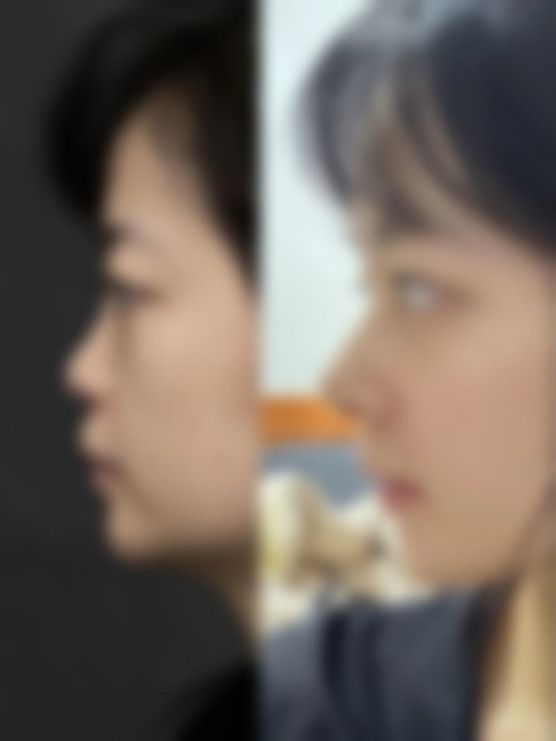 七、南京瑧颜医疗美容门诊部价格表：（仅供参考）