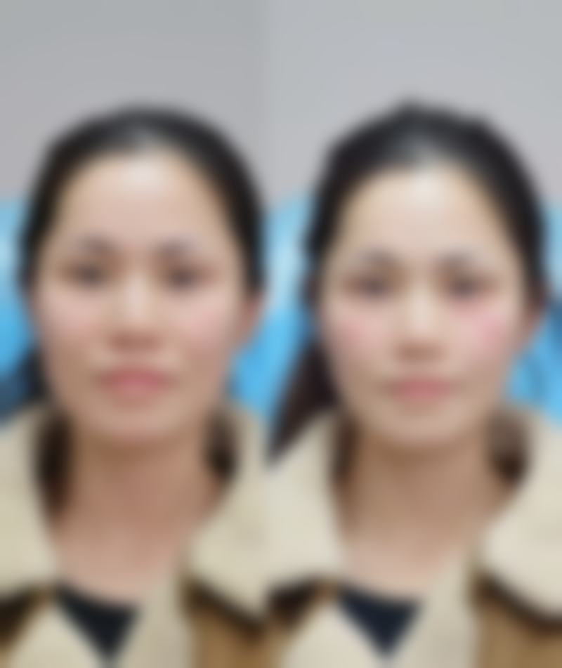七、昆明华美美莱整形美容医院价格表：（仅供参考）