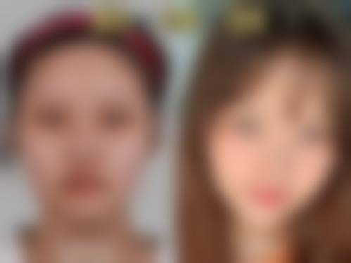 五、温州芙莱拉医疗美容医院实例