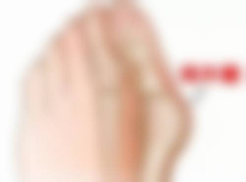 除皱针注意事项大揭秘:术后24小时内,小心呵护