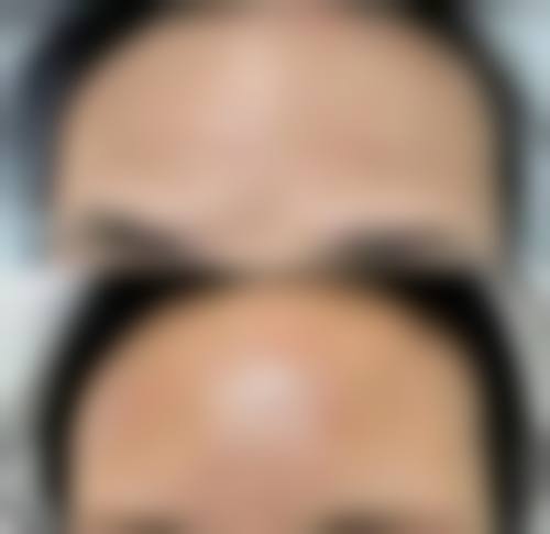 三、新疆库尔勒医院皮肤美容科医生介绍: