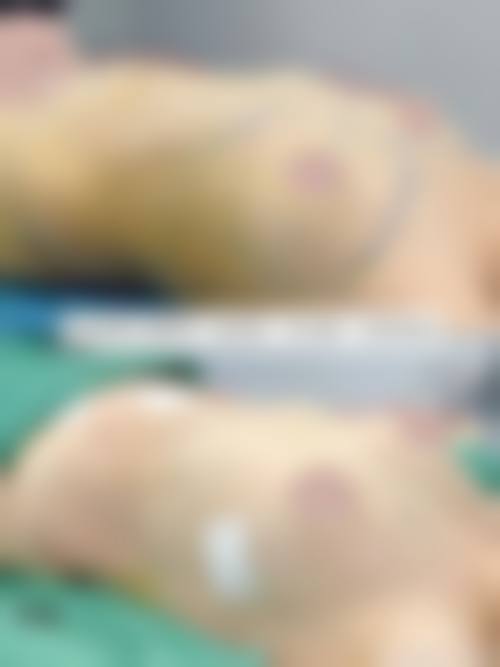 五、新疆库尔勒医院皮肤美容科实例