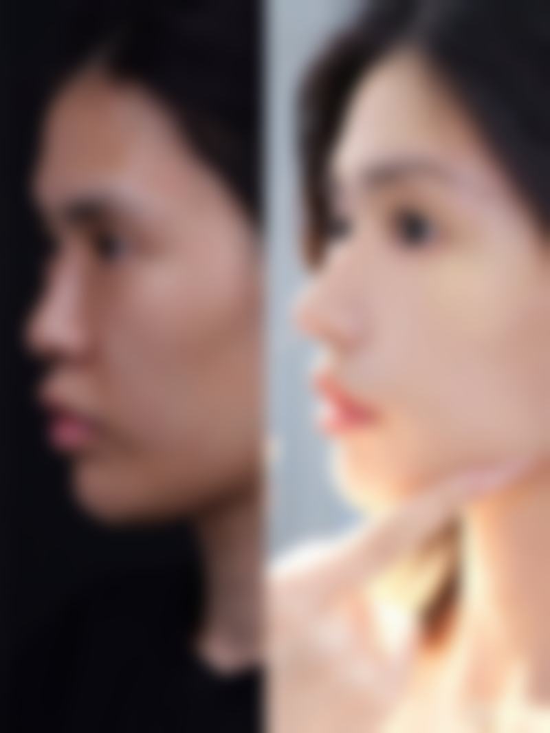 七、武汉金诺伊科丽妍整形医院真实的顾客评价如下：