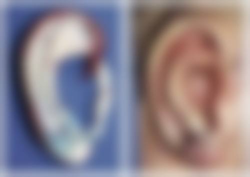 双眼皮全切手术后的修复过程中要注意什么？
