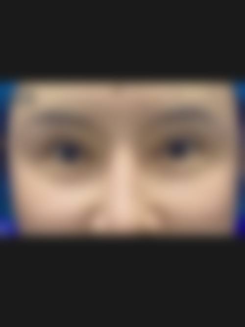 四、南宁莎蔓安吉拉医疗美容诊所实例