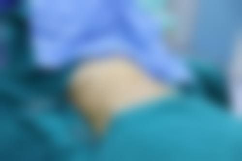 五、杭州丽颜辰医疗美容门诊部怎么预约：