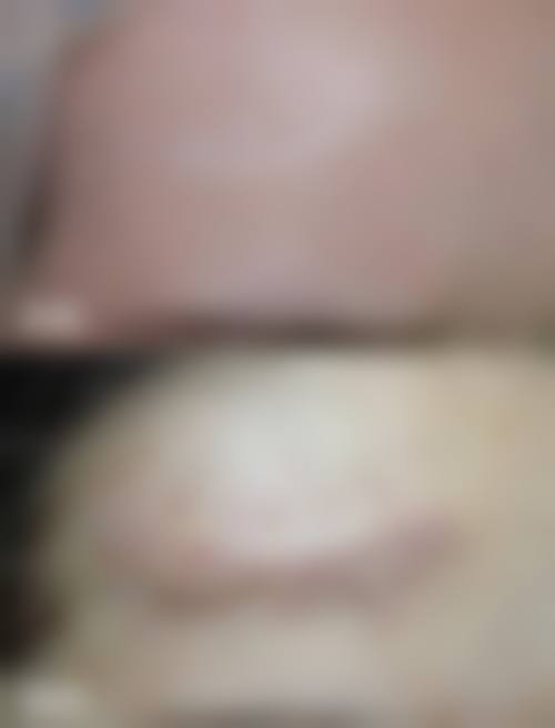 王洪杰医生怎么样可靠吗？