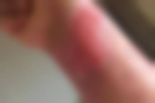 王洪杰医生实例