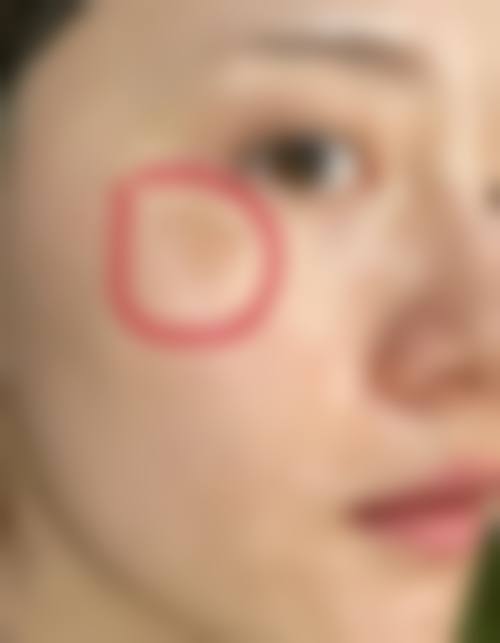 苗淑燕医生在哪家医院怎么预约？