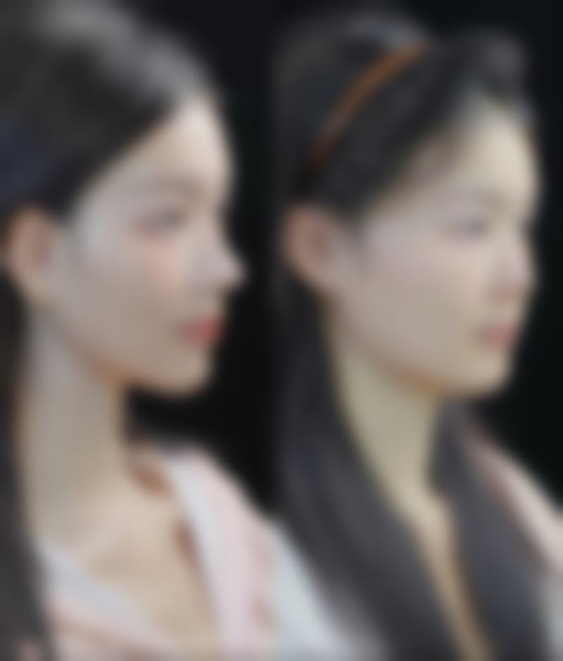 八、深圳悦色医疗美容诊所真实的顾客评价如下：
