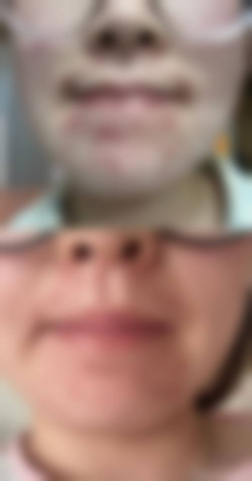 三、郴州市第三人民医院医疗美容科医生介绍: